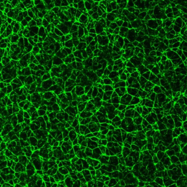 Immunostaining of vegetal cortex of Xenopus oocyte using 1h5 (stage IV oocyte; MeOH fix) showing geodesic keratin organization. Credit: Douglas Houston and Karen Thompson, University of Iowa